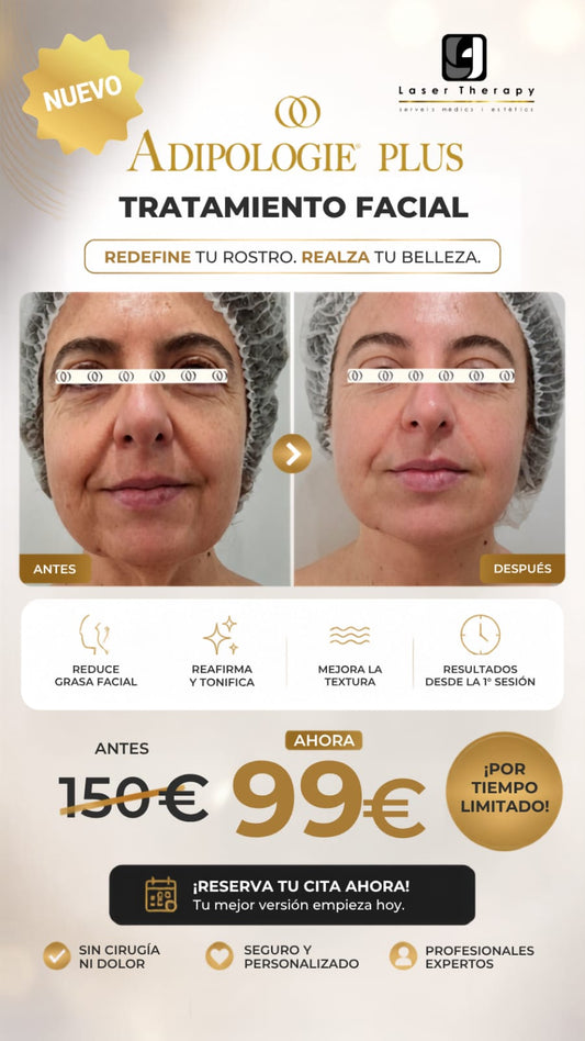 Adipologie Facial
